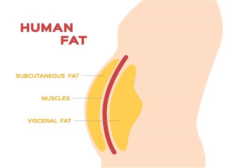 There Are Two Types of Body Fat — Here’s How to Deal With Both – Essence Laser