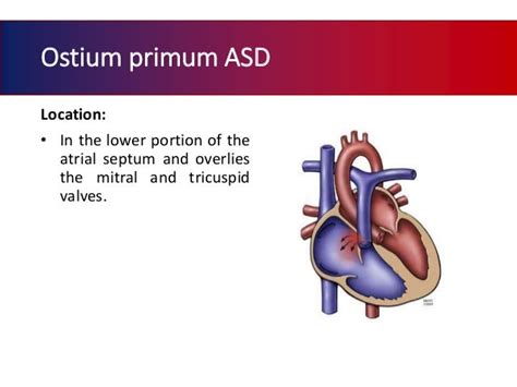 Atrial septal defect