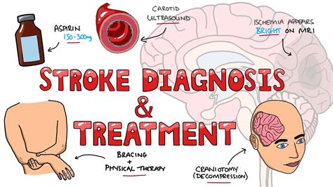 Stroke Diagnosis and Treatment - Acute and Long Term Treatment of Ischemic and Hemorrhagic ...