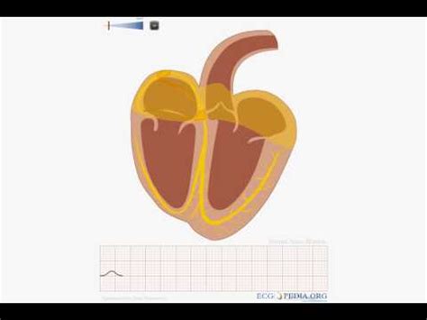 Animation of normal sinus rhythm - YouTube