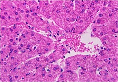 Hepatic Histology: Sinusoids