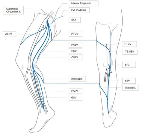 Superficial veins of the leg. Sapheno-femoral junction (SFJ), great ...