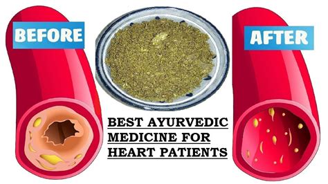 Homemade Medicine for HEART - NO SIDE EFFECTS | Ayurvedic Cure for Blocked or Clogged Heart ...