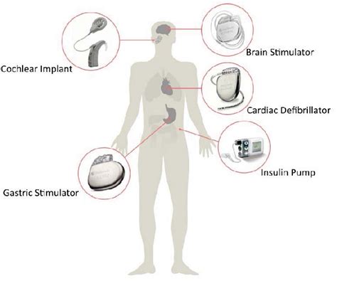 Cybersecurity Issues in Implanted Medical Devices | Semantic Scholar