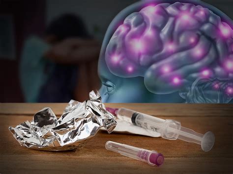 Brain Dysfunction Persists Years After Drug Abuse, Recovery