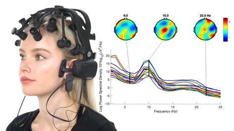 Customizing TMS Treatments with EEG Brain Mapping - Alfredo H. Arellano ...