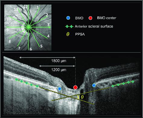 Illustration of the OCT scans of the optic nerve head and peripapillary ...