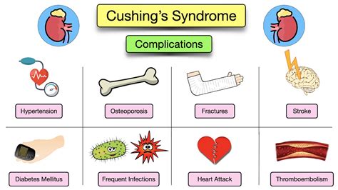 Cushing's Syndrome: Symptoms, Causes, Treatment, Diagnosis, Definitions ...