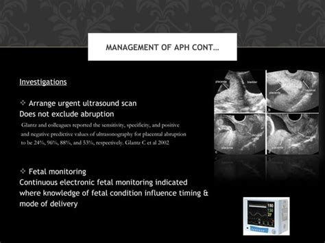 Antepartum hemorrhage