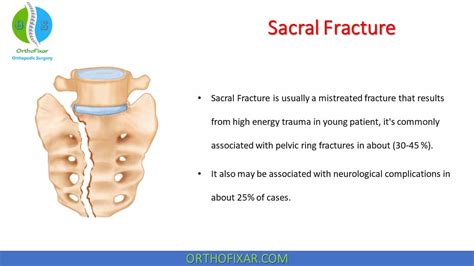 Distal Sacral Fracture