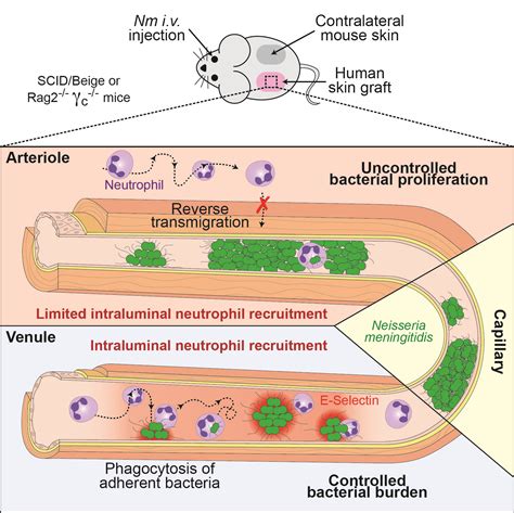 Neisseria Meningitidis Infection