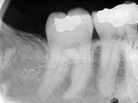 How to Remove Stubborn Tooth Roots - Veterinary Practice News