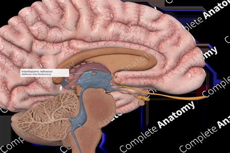 Interthalamic Adhesion | Complete Anatomy