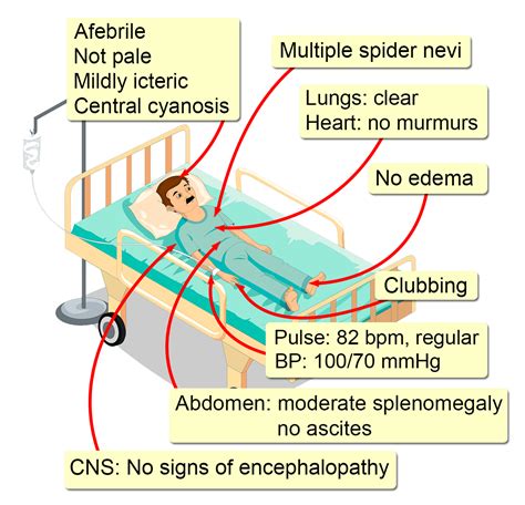 Hepatopulmonary Syndrome - Interactive case study | Clinical Odyssey by Medical Joyworks, LLC