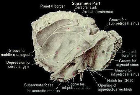 Bone Fissure