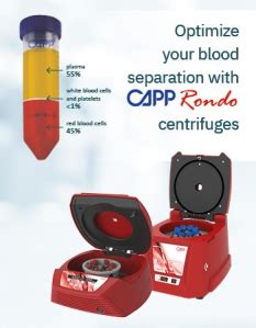 Blood Separation. Learn the process, techniques, recommendations