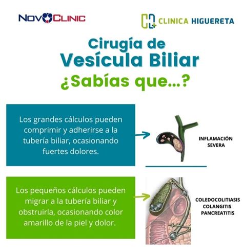 Cirugía de Vesícula Biliar (Extracción de la Vesícula) - Beneficios