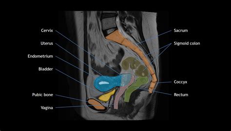 Uterus Anatomy Mri