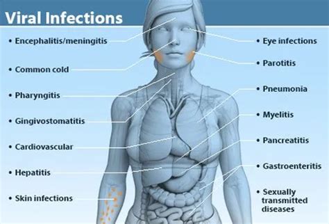 What's a Virus? Viral Infection Types, Symptoms, Treatment