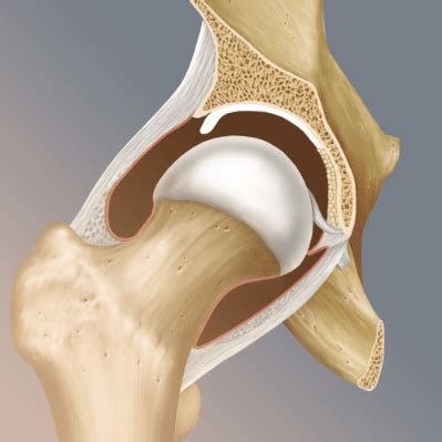 Hip Joint Labral Tear