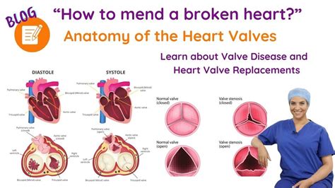 Heart valve anatomy, valve disease and heart valve replacement