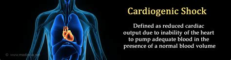 Cardiogenic Shock - Causes, Symptoms, Diagnosis, Treatment & Prevention