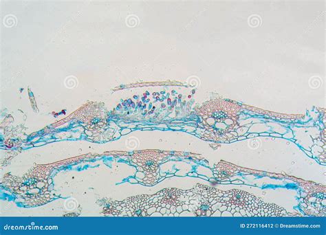 Microscope Photo of Steam Rust, Puccinia Graminis Stock Photo - Image ...