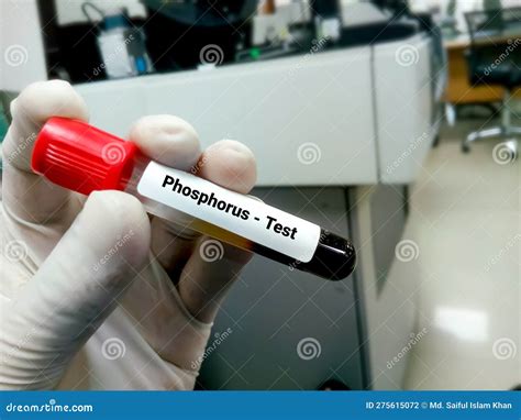 Phosphorus Test. Inorganic Phosphate Stock Photo - Image of illness ...