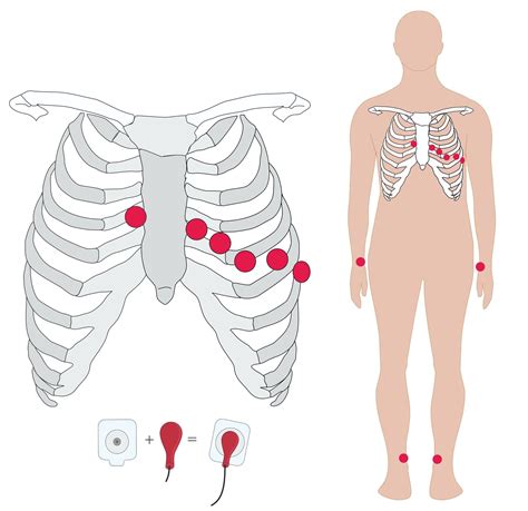 ECG Electrode Placement | Education