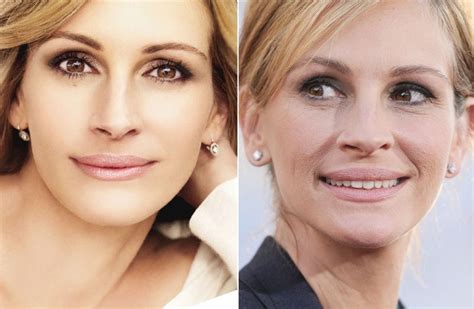 Julia Roberts plastic surgery - aging with more lively looks