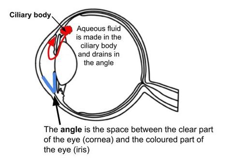 Narrow angles - Neuro-Ophthalmology