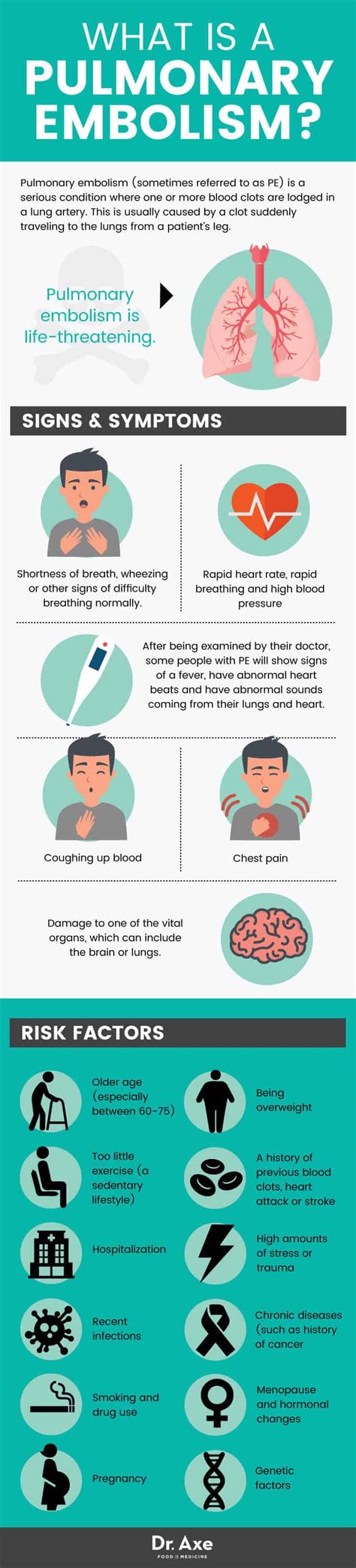 Pulmonary Embolism + 5 Natural Remedies for Prevention - Dr. Axe