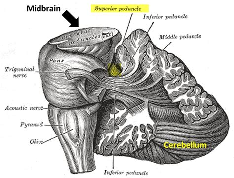 Multiple Sclerosis Research: Clinic speak: levetiracetam and tremor