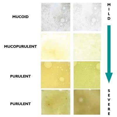 What does sputum color mean – The Meaning Of Color