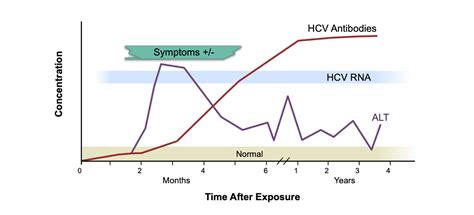 Active Hep C Viral Load