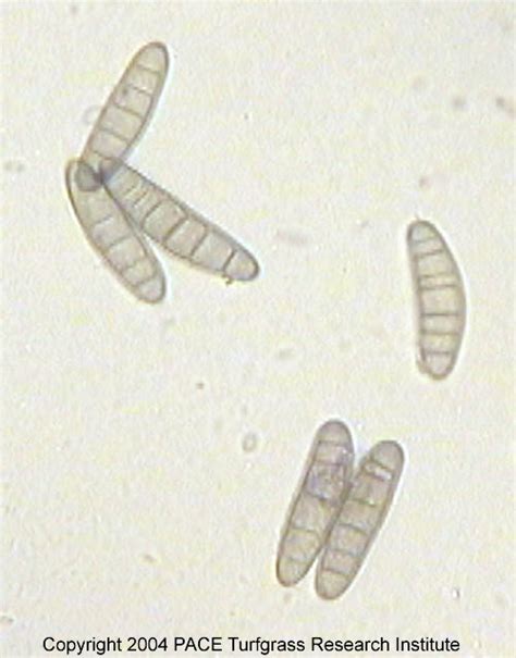 Bipolaris spores | PACE Turf Photo Gallery