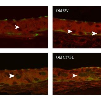 (a) Old C57BL mice display marked decreases in vessel number and size ...