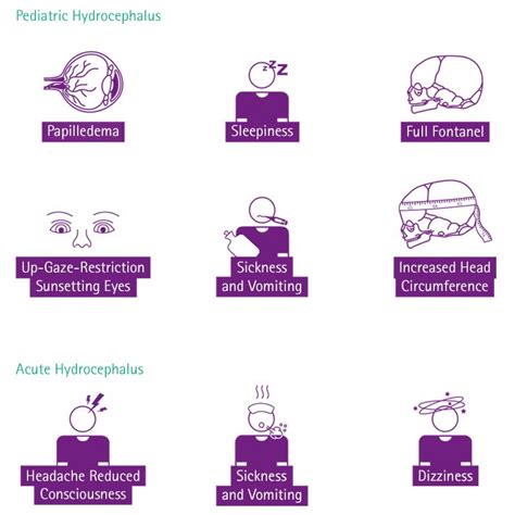 Symptoms And Causes Of Hydrocephalus