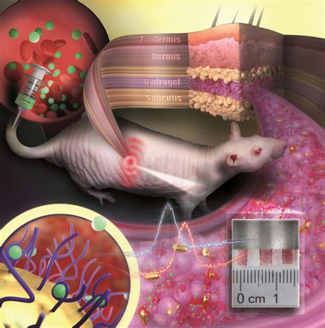 Implantable sensor made of gold nanoparticles could revolutionize ...