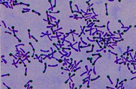 Listeria Monocytogenes Gram Stain - Listeria And Related Gram Positive ...