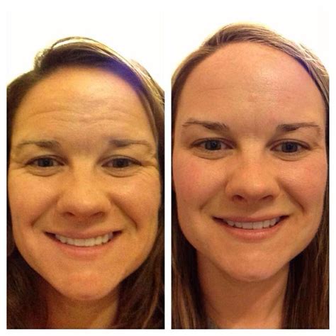 AMAZING RESULTS!! "Oct 28, 2013 to May 9, 2014.... I am currently using ...