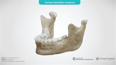 Mandible Bone Labeled