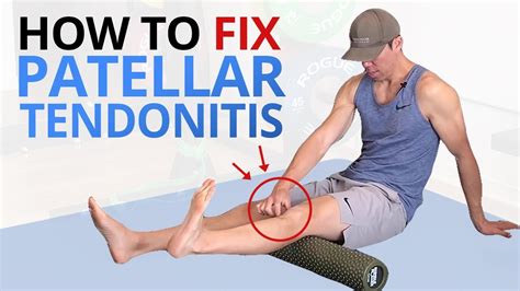 Why Common Patellar Tendonitis Rehab FAILS and 5 exercises that WORK! - YouTube