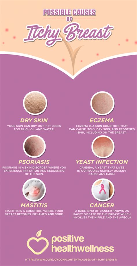 6 Possible Causes Of Itchy Breasts - Infographic