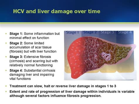 17 Best images about Liver Fibrosis on Pinterest | A well, Disorders ...