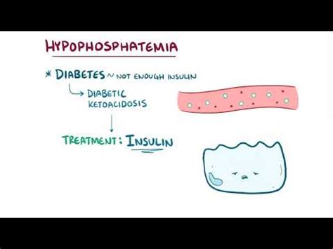 Hypophosphatemia causes, symptoms, diagnosis, treatment, pathology - YouTube