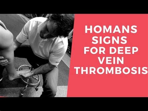 Homans sign: what is it, usefulness and diagnosis for DVT - science - 2024