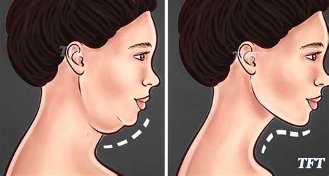 THE BEST EXERCISES FOR GETTING RID OF THAT UNWANTED DOUBLE CHIN AND ...