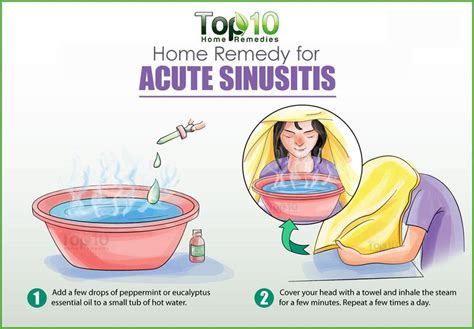 Home Remedies for Acute Sinusitis | Top 10 Home Remedies