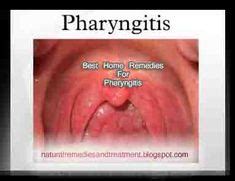 herpangina...coxsackie virus - Google Search | ENT | Sore throat ...